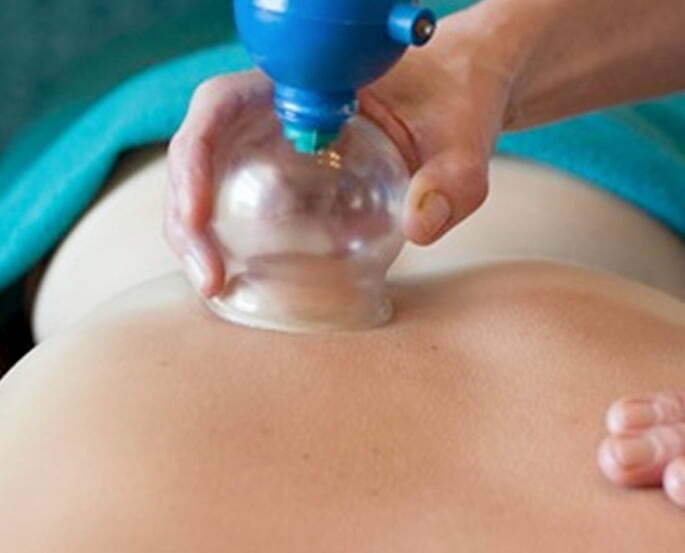 transformational cupping cup