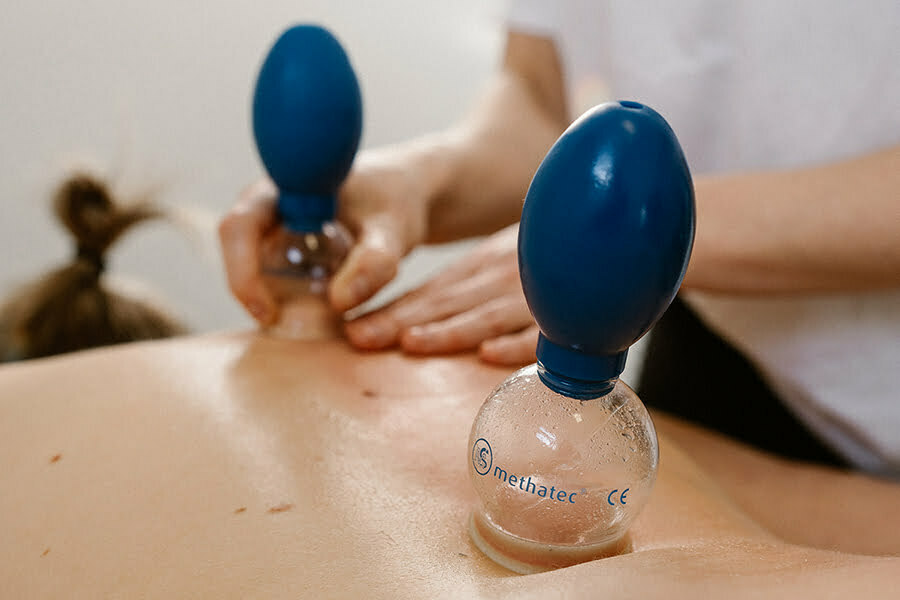 experience transformational cupping blog