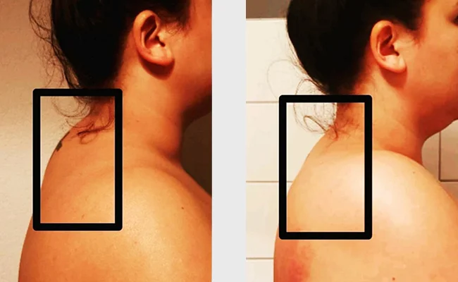 transformational cupping opleiding 1