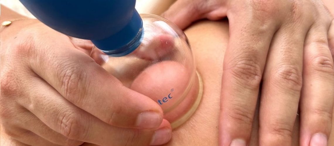 blog_transformational_cupping_6